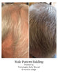 Thicker, Healthier-Looking Hair Starts at the Scalp